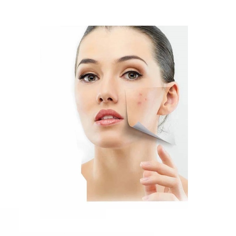 ژل کرم شفاف کننده ضد جوش acne series الی ژن