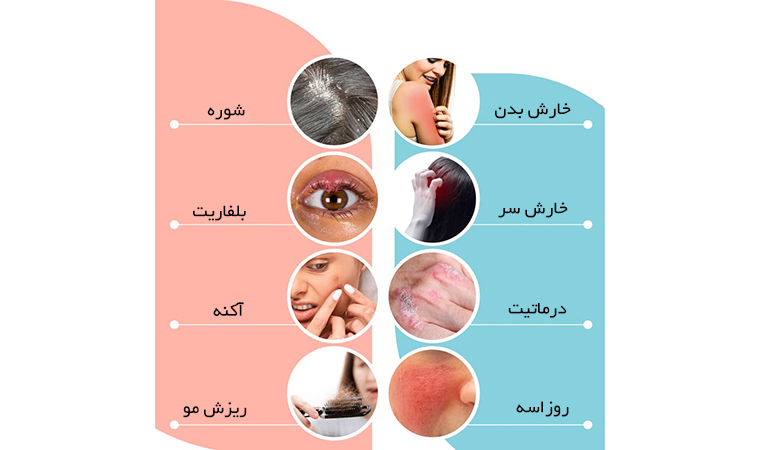راهکار مراقبت از پوست انگل دمودکس