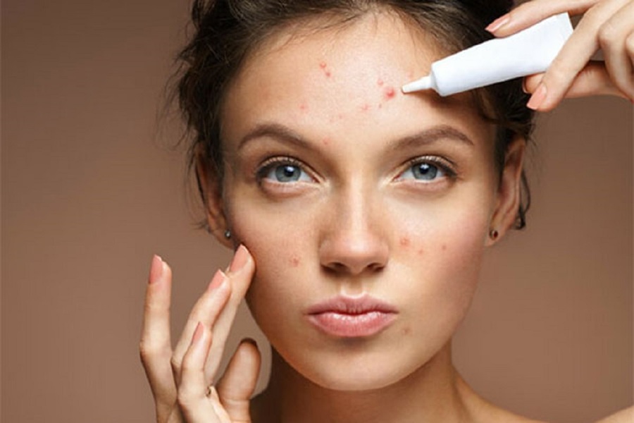 مراقبت پوست